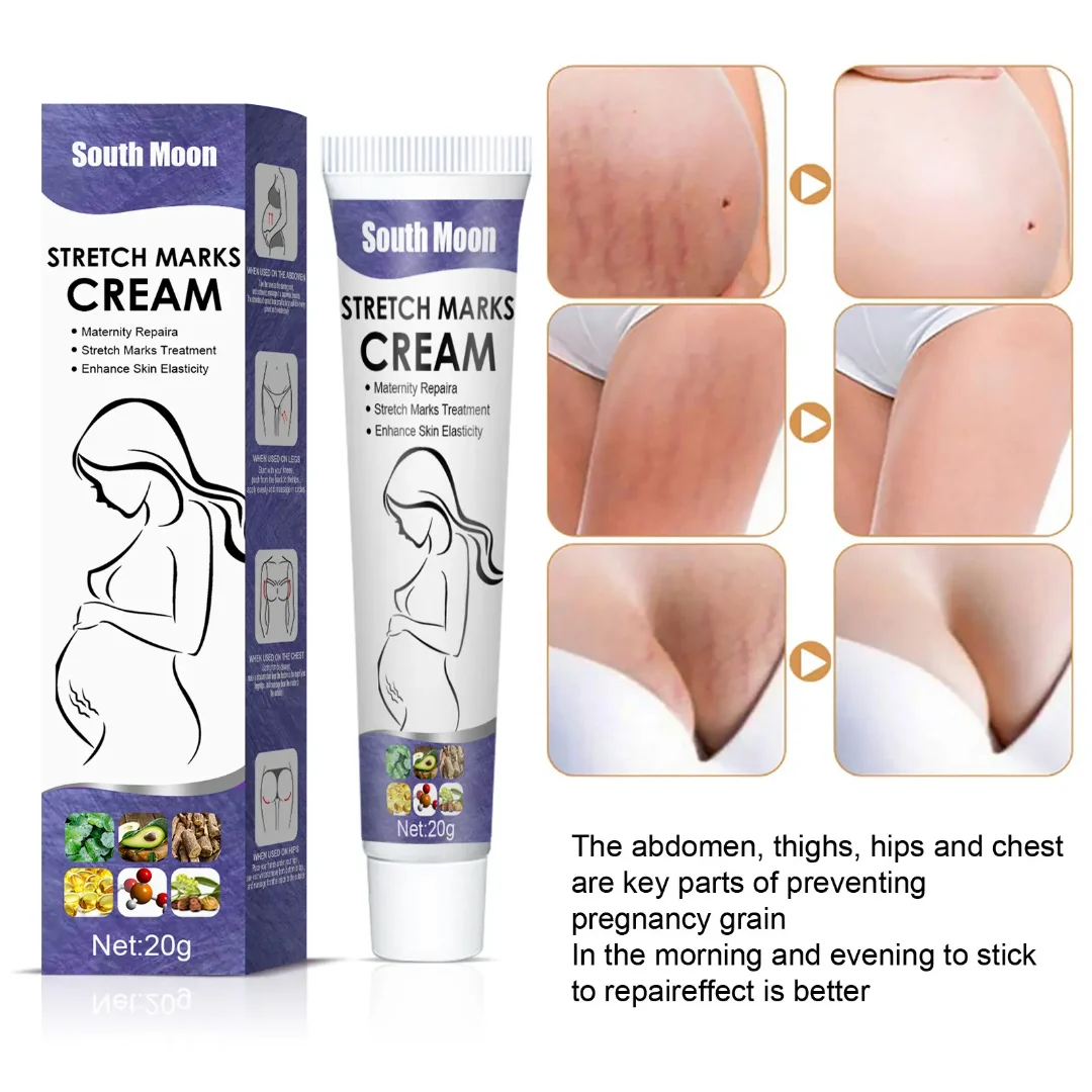 0966440_south-moon-stretch-marks-cream-20g