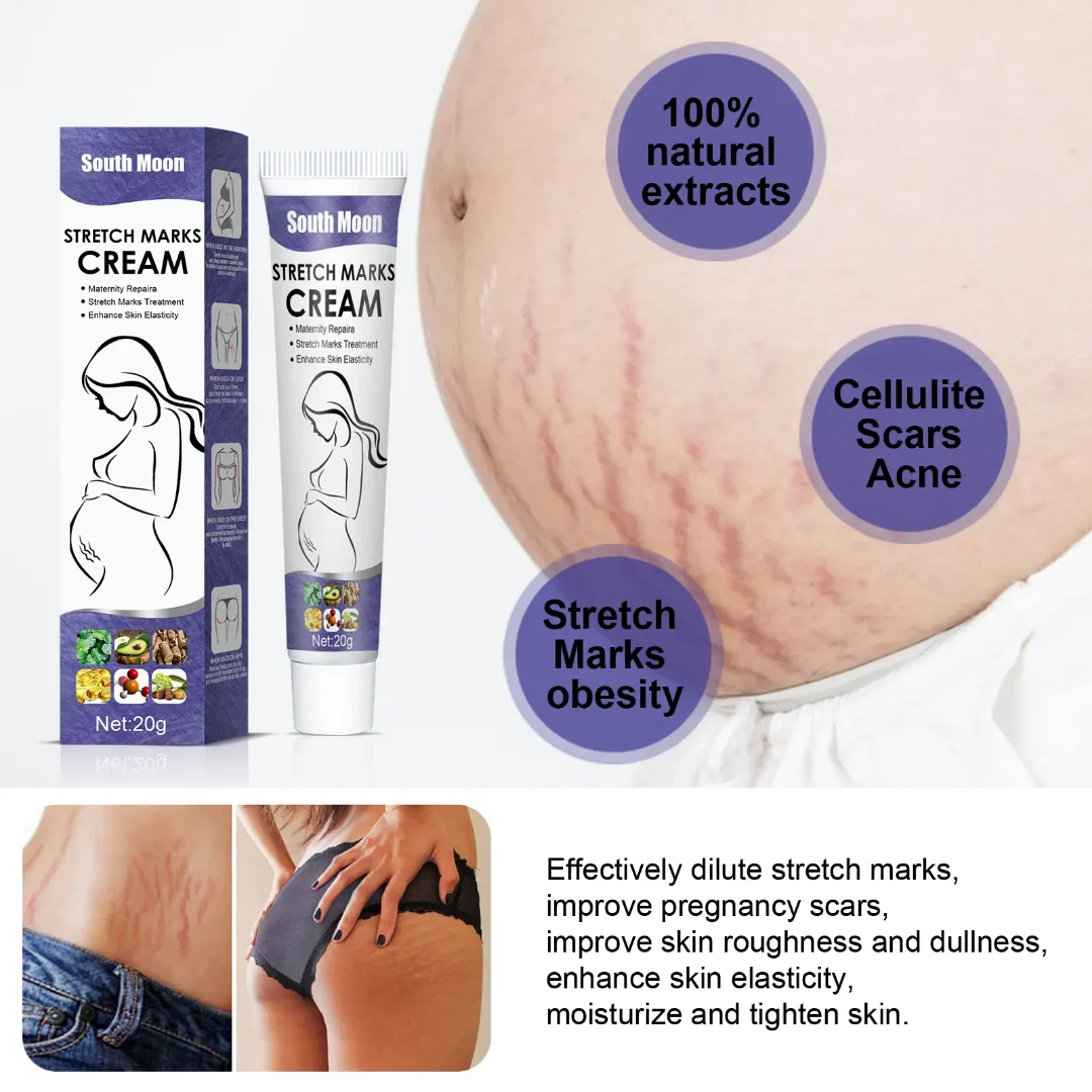 0966441_south-moon-stretch-marks-cream-20g